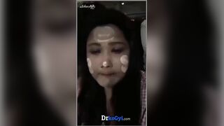 ဒါလေးကအပိုင်း @ 2